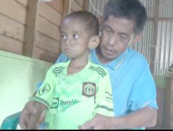 Anak Tinggal Di Pusat Kota Arga Makmur, Mengalami Gizi Buruk